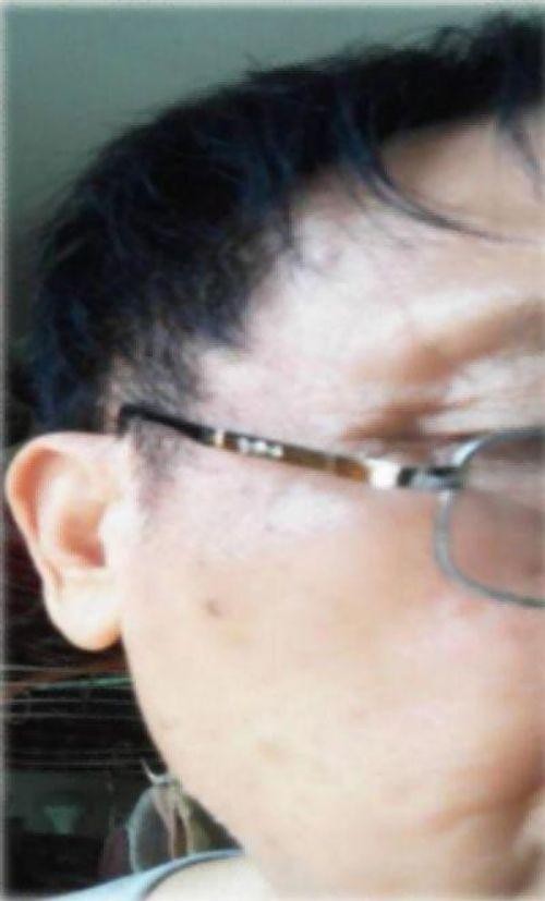 量子氢氧健康第一人长寿哥（廖永贵）