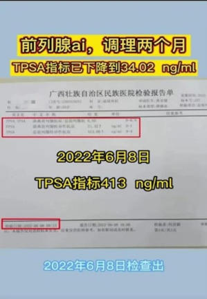 金秀瑶族灯草灸疗法瑶医药非物质文化遗产传承人---赵衷民