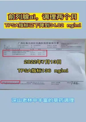 金秀瑶族灯草灸疗法瑶医药非物质文化遗产传承人---赵衷民