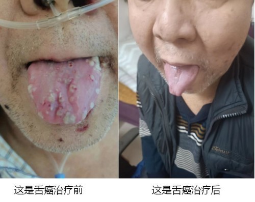 2026中国医学功勋人物报道 广西百色市杨忠雅治疗各种癌症有成就