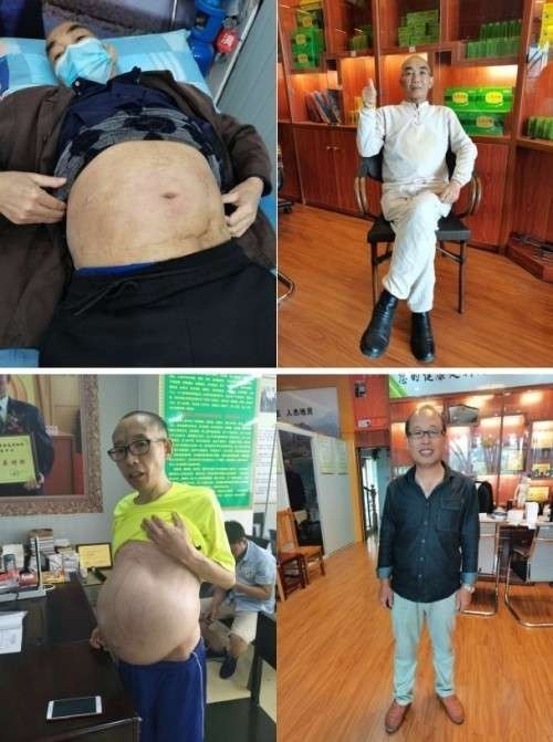 2026中国医学功勋人物报道 广西百色市杨忠雅治疗各种癌症有成就