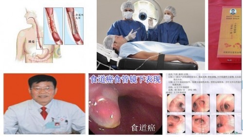 冉明医师创新国医精粹 铺就患者“健康之路”