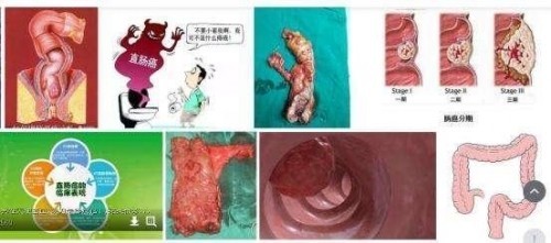 冉明医师创新国医精粹 铺就患者“健康之路”