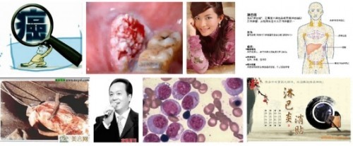 冉明医师创新国医精粹 铺就患者“健康之路”