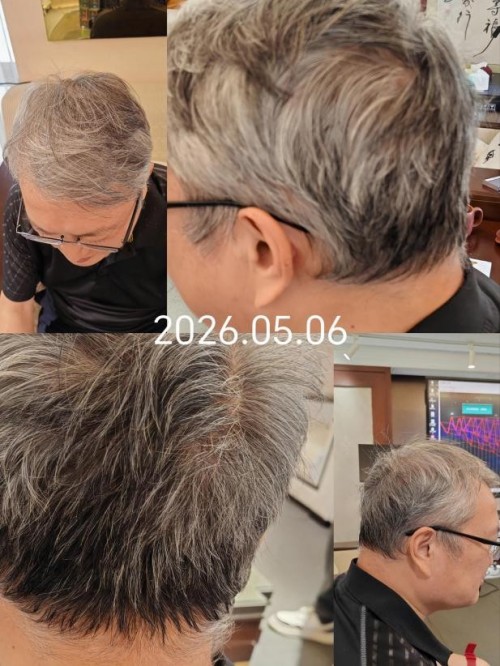 非介入式脑机交互 打造数智健康生态